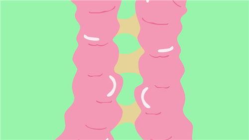 龟头粘连分离视频,龟头粘连分离手术视频详解