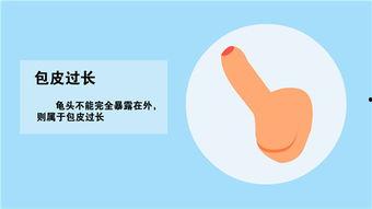 龟头粘连分离视频,龟头粘连分离手术视频详解