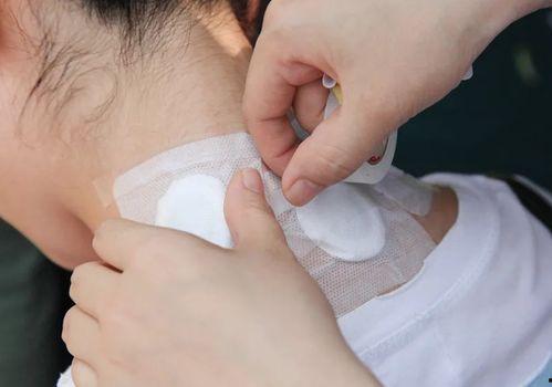 贴敷视频,贴敷疗法操作全解析